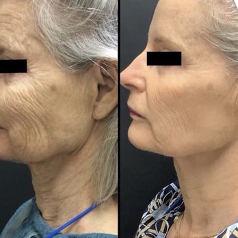 Rejuvenate & Wellness Center Lakeland | 4019 US Hwy 98 N Suite 124, Lakeland, FL 33809, USA | Phone: (321) 294-3586