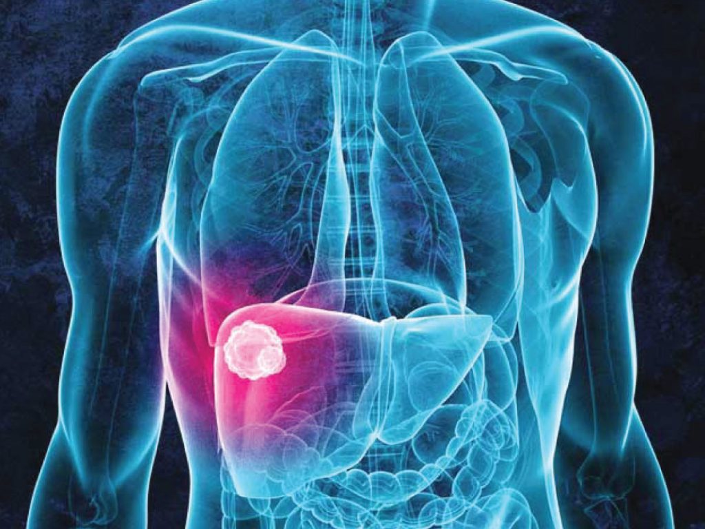 Integrative Cancer Centers of America | 4370 La Jolla Village Dr, San Diego, CA 92122, United States | Phone: (888) 526-6398