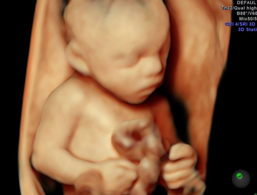 Keepsake Prenatal Imagaing 3D/4D HD Ultrasound Studio | 5656 US-29, Blairs, VA 24527, USA | Phone: (434) 429-1069