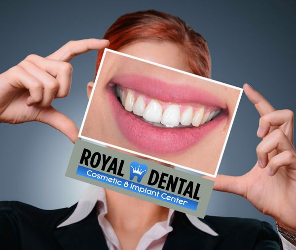 Royal Dental Center | 4819 Haggerty Rd, West Bloomfield Township, MI 48323, USA | Phone: (248) 863-9109