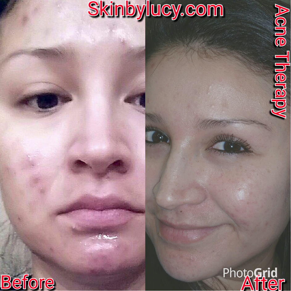 Skin by Lucy Med | 4222 Trinity Mills Rd, Dallas, TX 75287, USA | Phone: (972) 854-2267