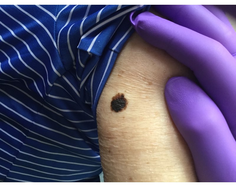 Dermatology Partners | 400 Cresson Blvd Suite 320, Oaks, PA 19456, USA | Phone: (610) 994-2250