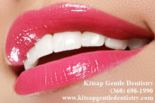 Kitsap Gentle Dentistry | 9910 Levin Rd NW, Silverdale, WA 98383, USA | Phone: (360) 698-1990