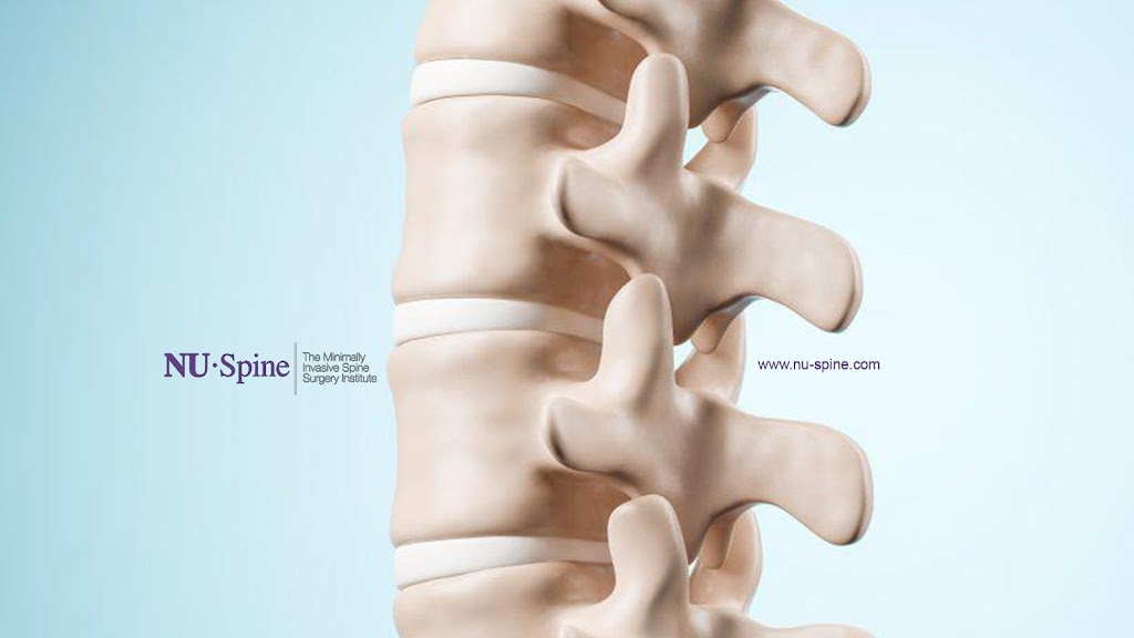 Middle & Low Back Pain Treatment And Relief | 21 Kilmer Rd, Edison, NJ 08899, USA | Phone: (732) 929-7002