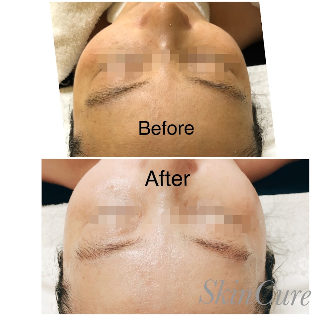 SkinCure K-beauty Spa | 5257 Stevens Creek Blvd, Santa Clara, CA 95051, USA | Phone: (408) 230-9608