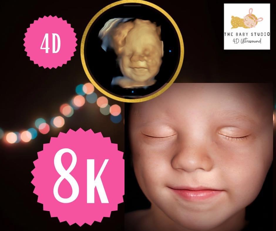 The Baby Studio 4D Ultrasound | 111 N 5th St, Chickasha, OK 73018 | Phone: (405) 759-4051