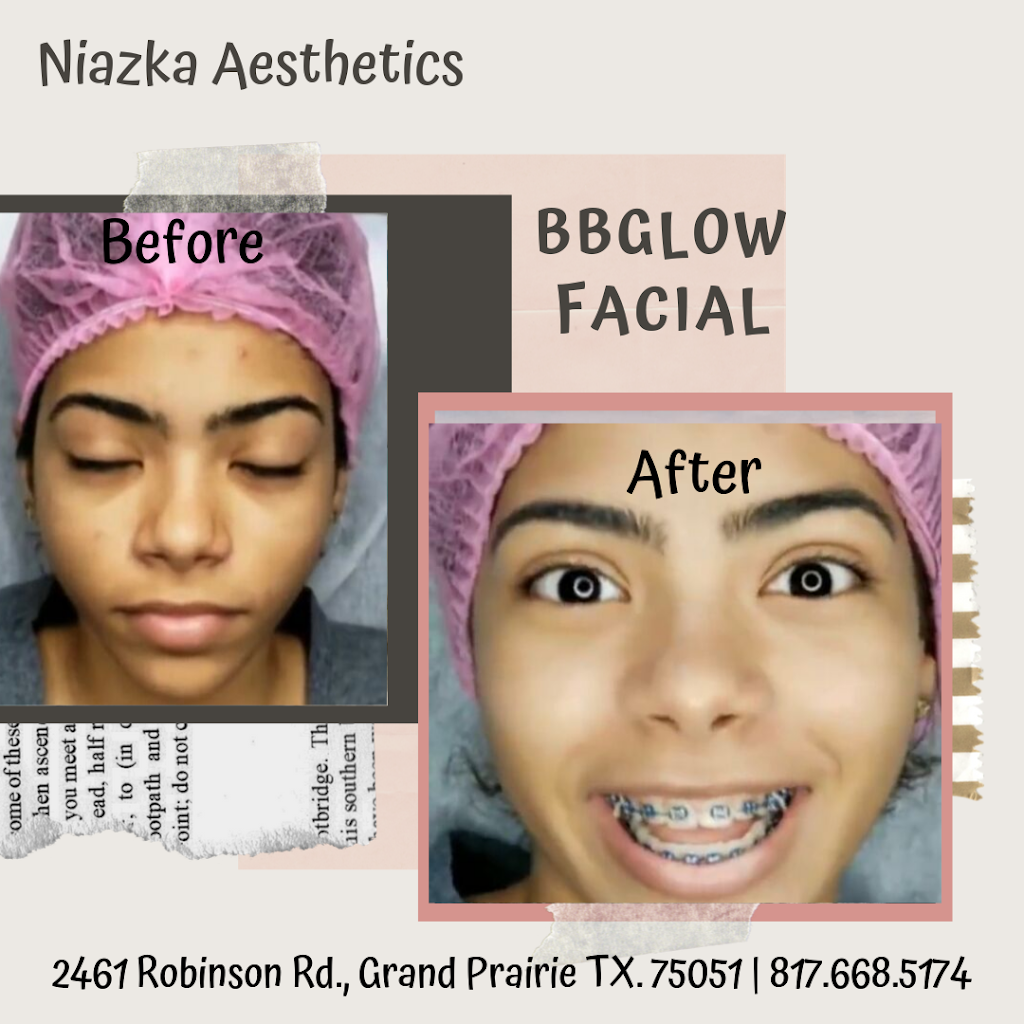 Niazka Aesthetics | 2461 Robinson Rd, Grand Prairie, TX 75051, USA | Phone: (817) 668-5174