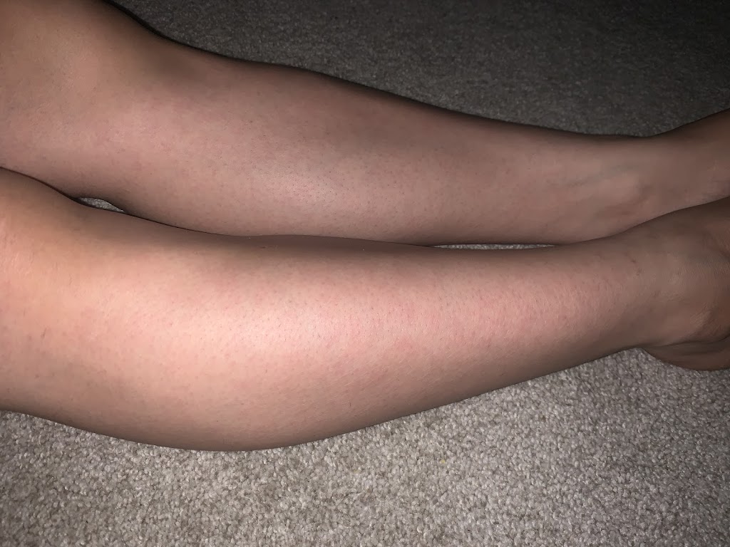 Dream Esthetics | 740 Texas St, Fairfield, CA 94534, USA | Phone: (707) 631-3583