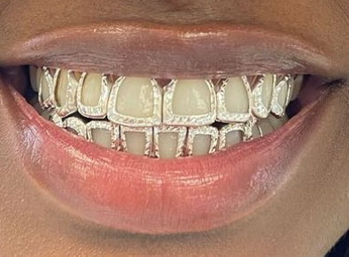 Gold Teeth Master | 3503 E Hillsborough Ave B, Tampa, FL 33610, USA | Phone: (813) 997-9247