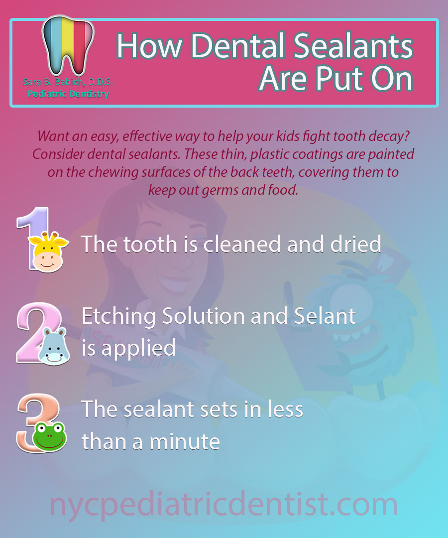 Pediatric Dentistry: Dr. Sara B. Babich, DDS | 116 E 84th St, New York, NY 10028, United States | Phone: (212) 988-4070