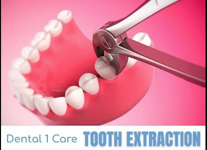 Dental 1 Care | 4147 Metro Pkwy Ste 101, Sterling Heights, MI 48310, United States | Phone: (586) 217-2034