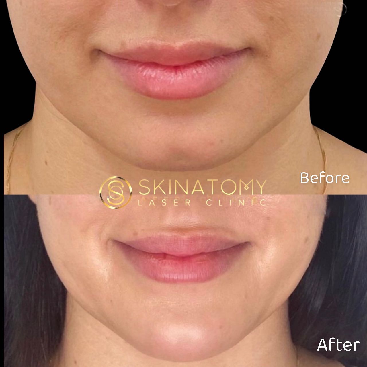 Skinatomy Laser Clinic | 4092 Confederation Pkwy, Mississauga, ON L5B 0G4, Canada | Phone: (905) 949-9198
