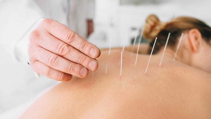 Best Care Acupuncture | 22227 Redwood Rd, Castro Valley, CA 94546, USA | Phone: (510) 881-1198