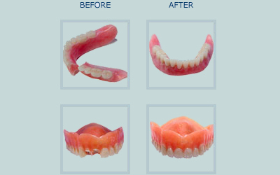 Gentle Dental: Emil Sedrakyan DDS | 1003 North Point Blvd #602, Baltimore, MD 21224, USA | Phone: (410) 282-8313