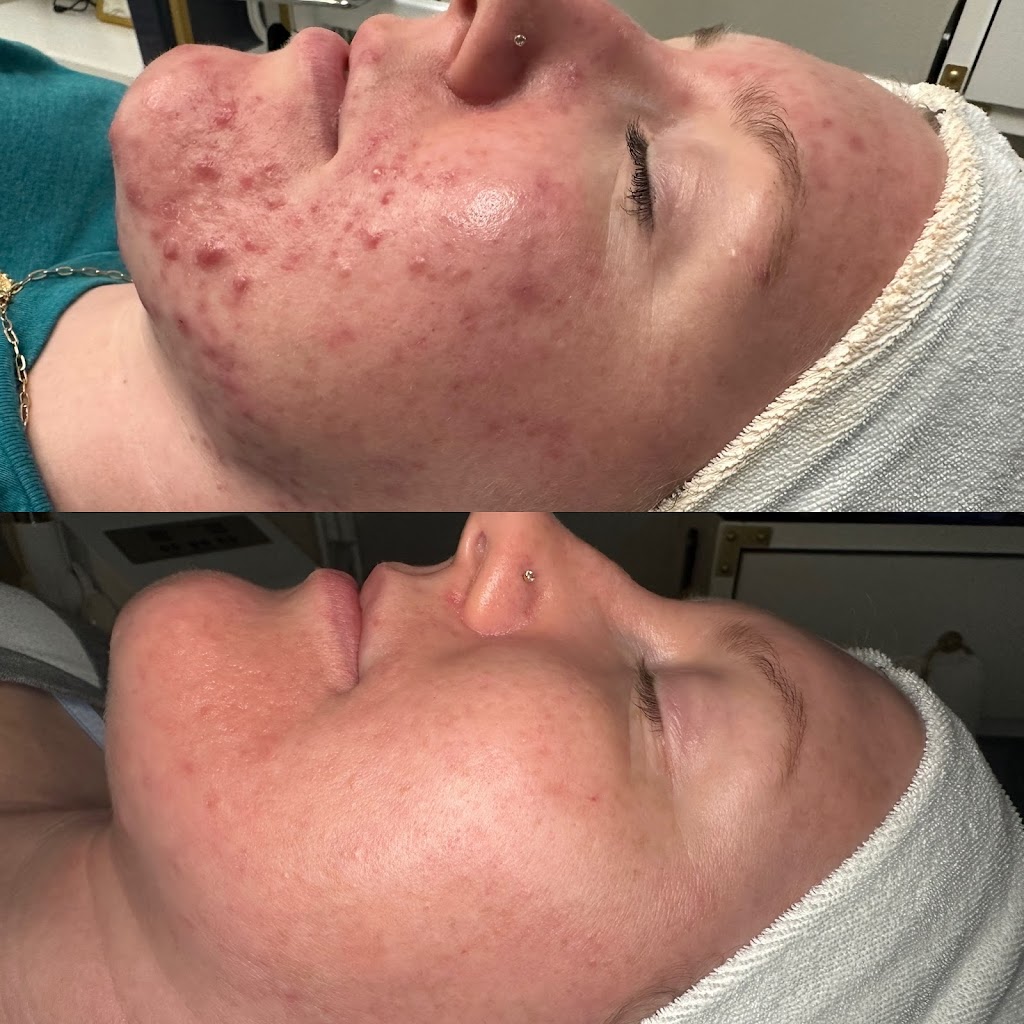 Strickly Skin Esthetics | 105 E Oak St Ste. 101, Mansfield, TX 76063, USA | Phone: (817) 320-8485