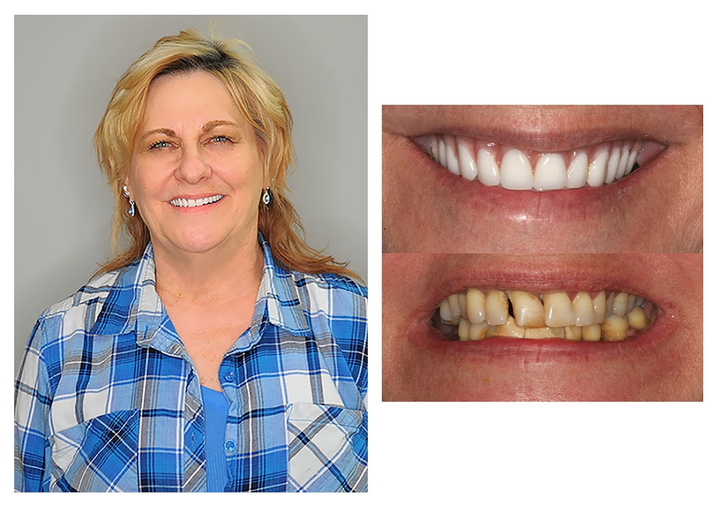 4M Dental Implant Center | 20331 Irvine Ave Suite E7, Newport Beach, CA 92660, USA | Phone: (949) 646-2420