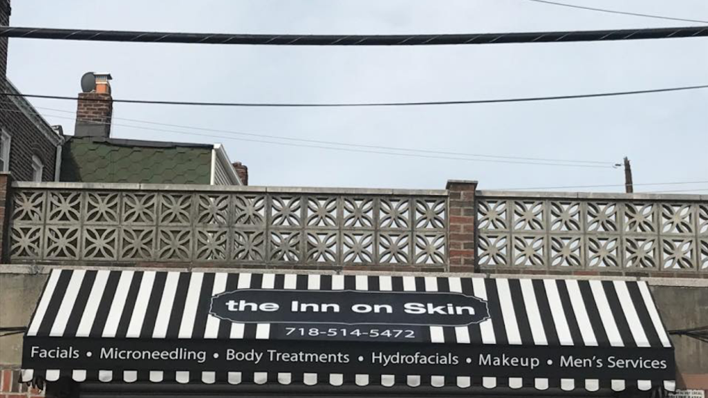 the inn on skin | 80-21 Myrtle Ave, Glendale, NY 11385, USA | Phone: (718) 514-5472