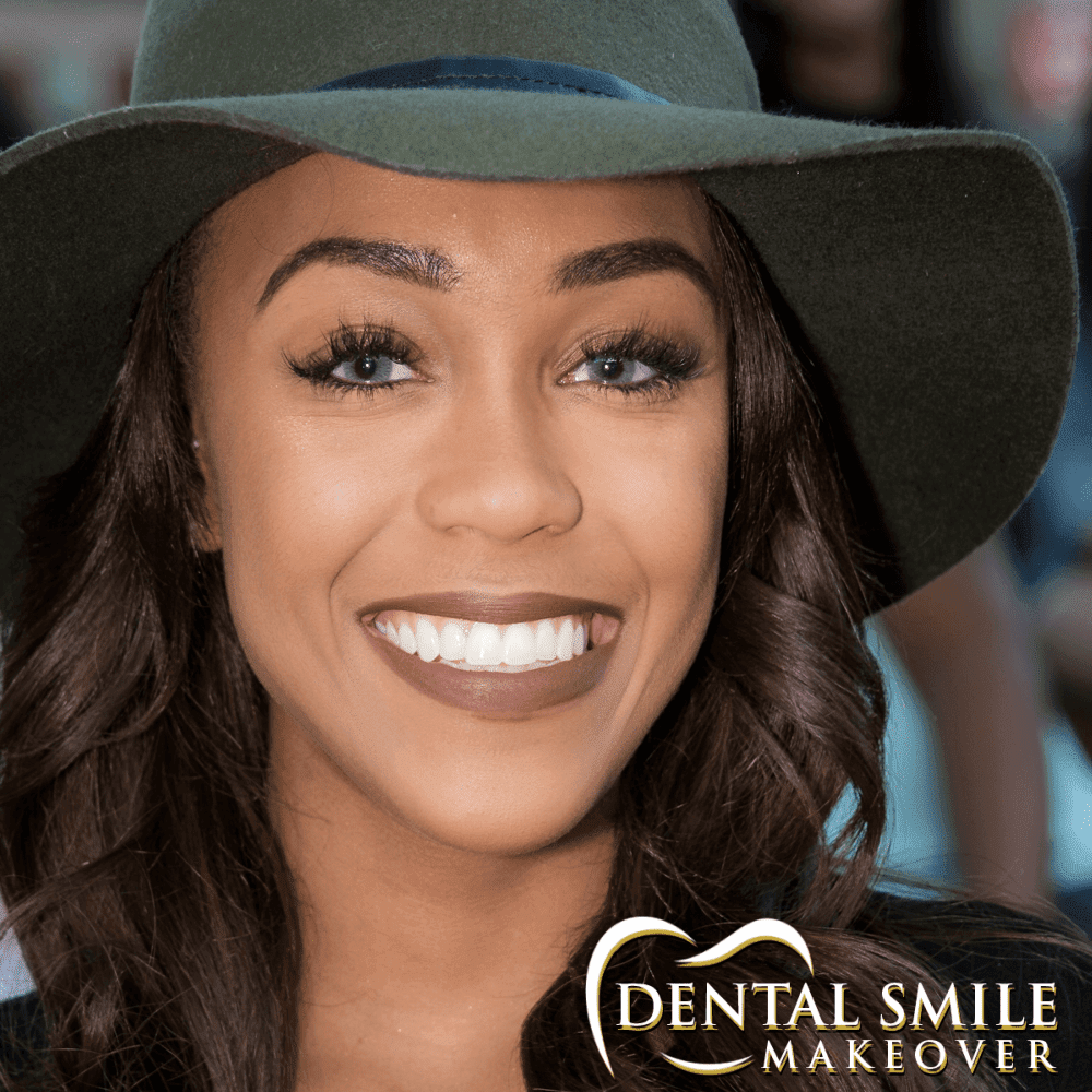 Dental Smile Makeover | 2090 Godby Rd, College Park, GA 30349, USA | Phone: (770) 991-0212