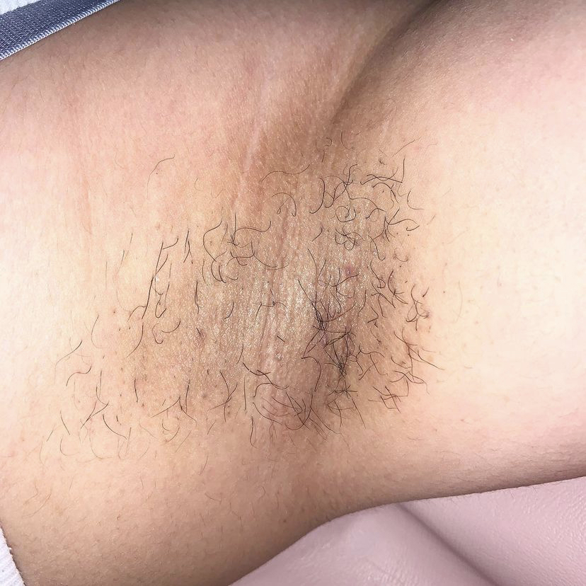 Dream Esthetics | 740 Texas St, Fairfield, CA 94534, USA | Phone: (707) 631-3583