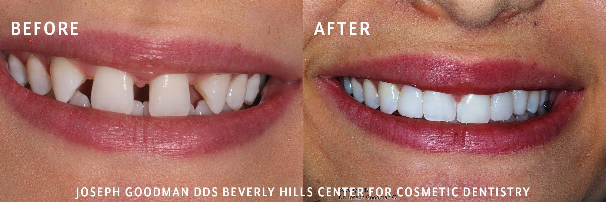 Dr. Joseph Goodman | Beverly Hills Dentist | 241 1/2 S Beverly Dr Suite 201, Beverly Hills, CA 90212, United States | Phone: (310) 860-9311