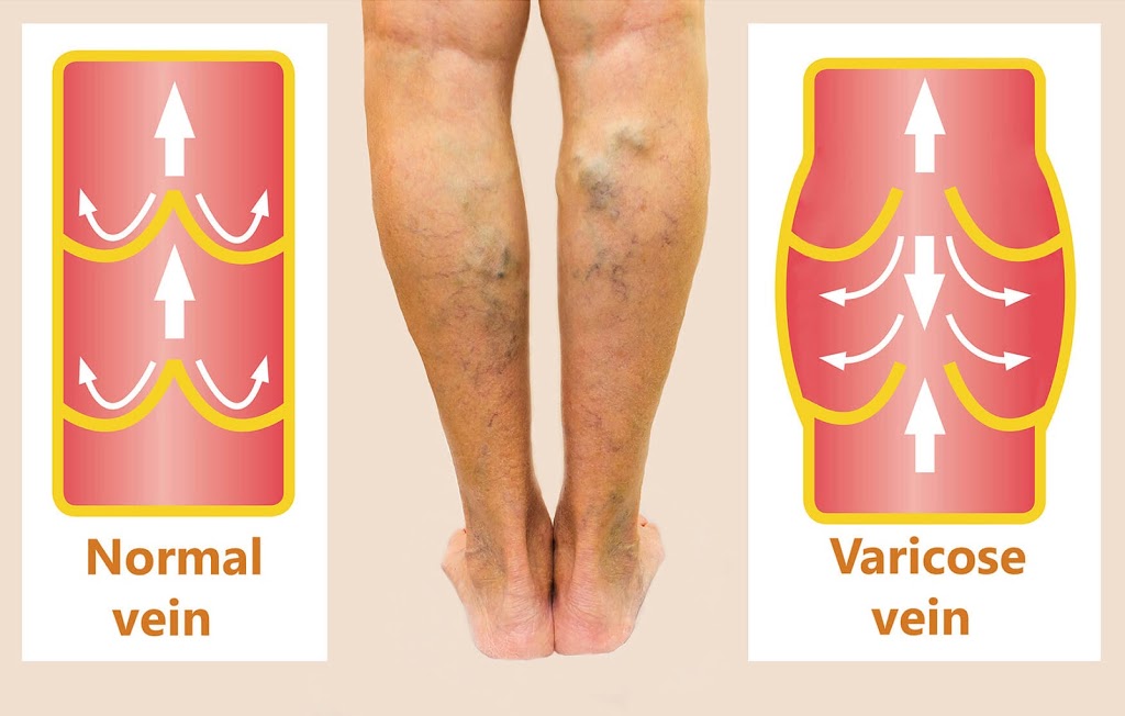 Vein Envy | 14044 W Camelback Rd #226, Litchfield Park, AZ 85340, USA | Phone: (623) 233-1050