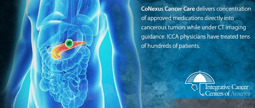 Integrative Cancer Centers of America | 4370 La Jolla Village Dr, San Diego, CA 92122, United States | Phone: (888) 526-6398
