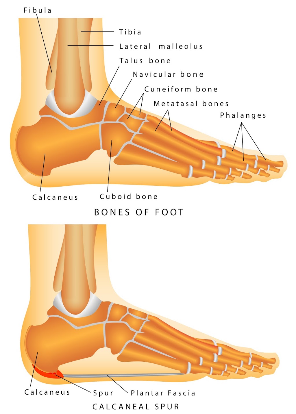 Beaver Valley Foot Clinic | Pittsburgh | 447 Maplewood Ave, Ambridge, PA 15003, USA | Phone: (724) 266-5959