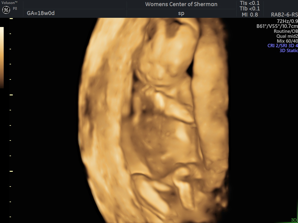 Print preview in Utero Photography 3d | 2901 Overland Trail Suite 100, Sherman, TX 75092, USA | Phone: (918) 348-9796