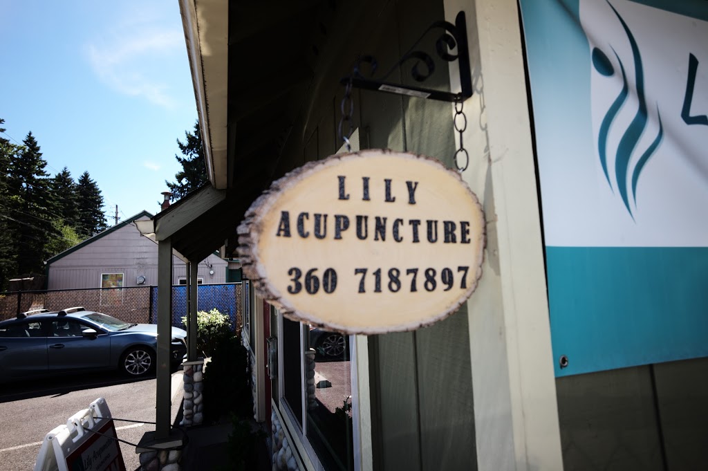 Lily Acupuncture Healing Space | 1912 Grand Blvd, Vancouver, WA 98661, USA | Phone: (360) 718-7897