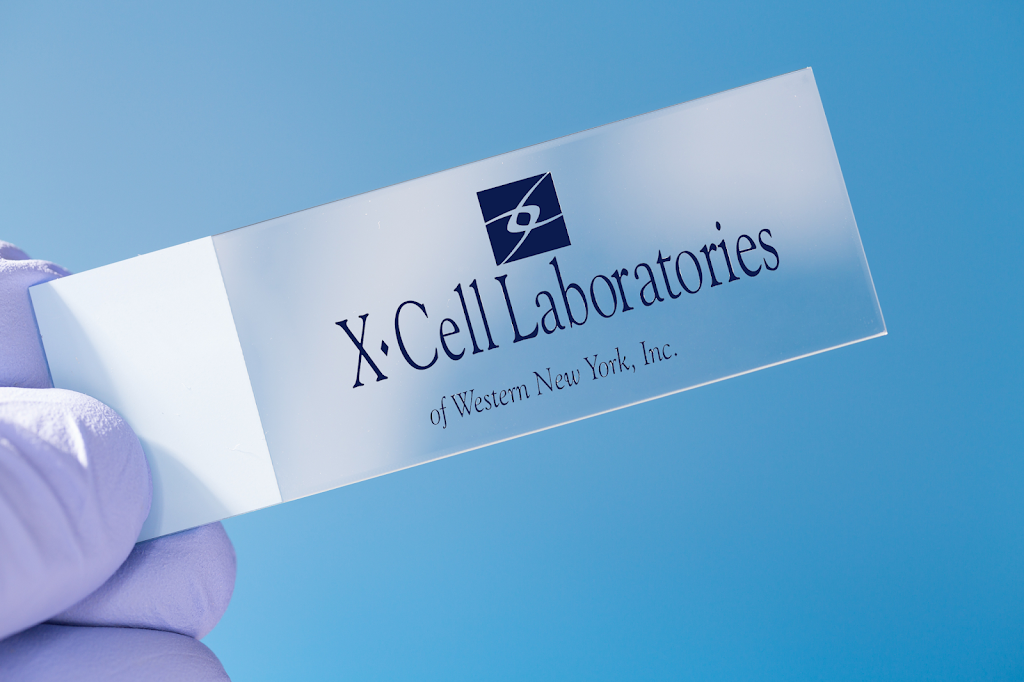 X-Cell Laboratories of Western New York | 20 N Pointe Pkwy #100, Buffalo, NY 14228, USA | Phone: (716) 250-9235