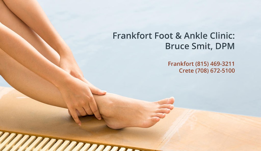 Frankfort Foot & Ankle Clinic: Bruce Smit, DPM | 9875 W Lincoln Hwy Ste 101, Frankfort, IL 60423, USA | Phone: (815) 469-3211