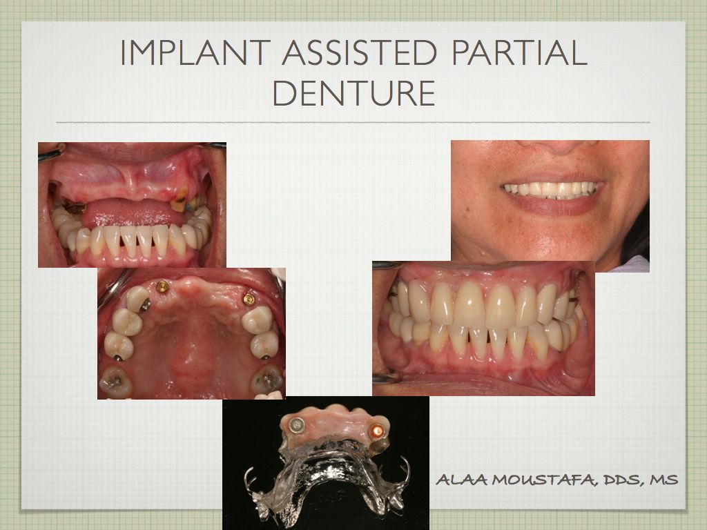 Alaa Moustafa, DDS, MS | 47 Penny Ln, Watsonville, CA 95076, USA | Phone: (831) 724-4539