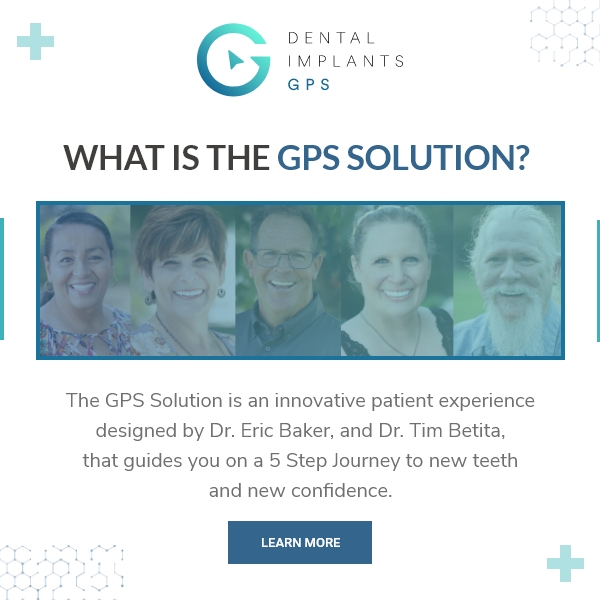 Dental Implants GPS | 7891 Talbert Ave STE 101, Huntington Beach, CA 92648, United States | Phone: (714) 842-2521