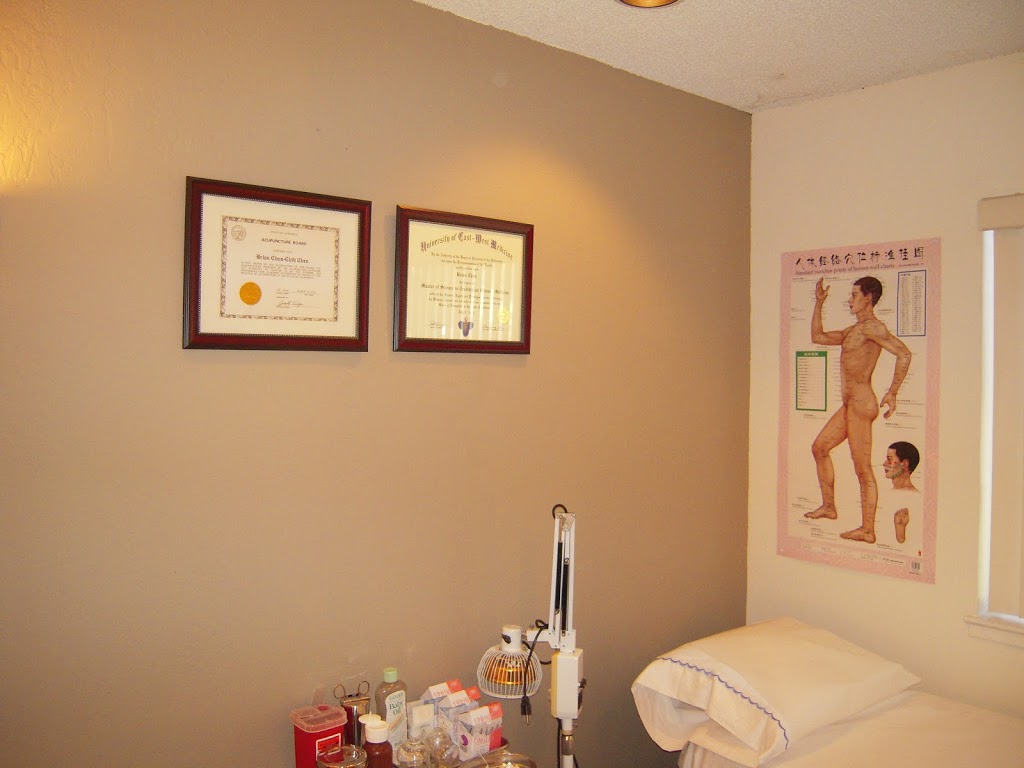 88 Acupuncture Clinic | 650 Mowry Ave, Fremont, CA 94536, USA | Phone: (408) 306-4118