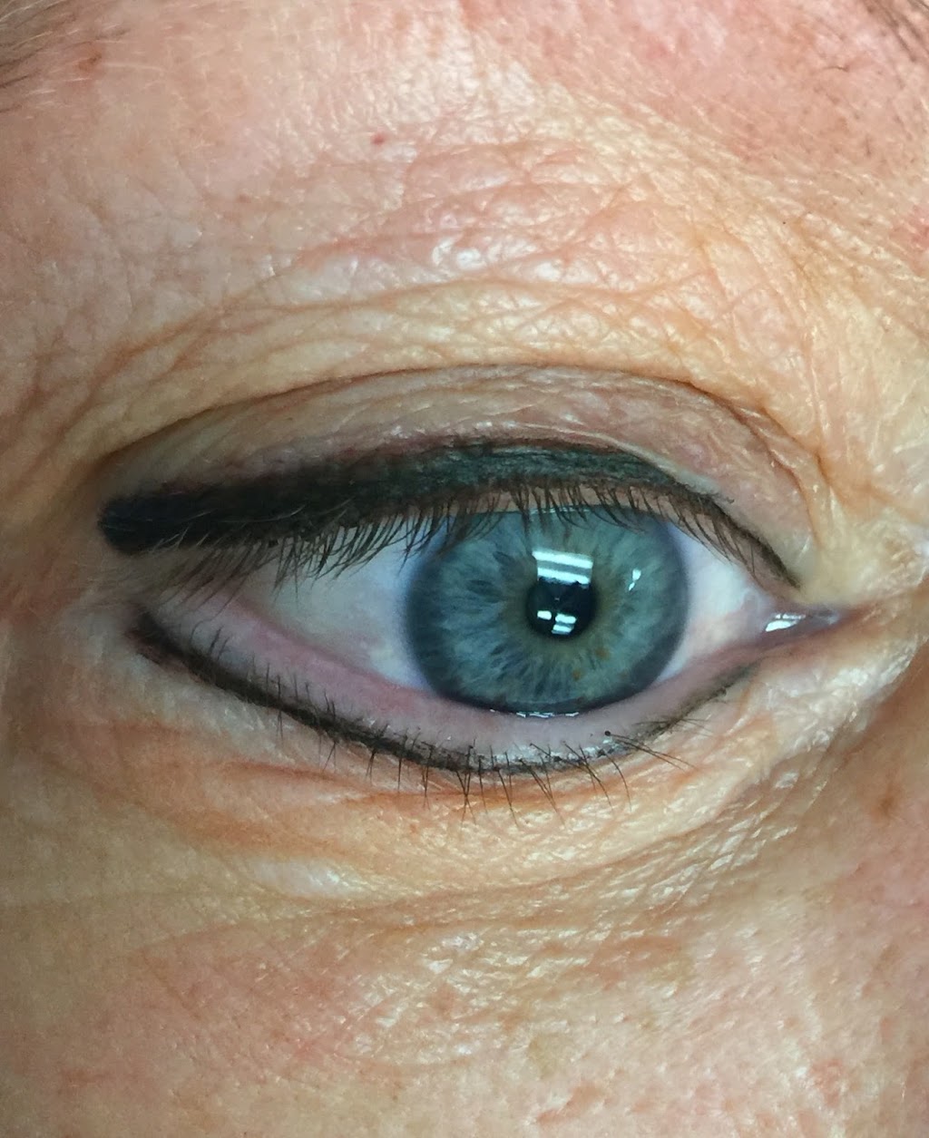 Your Body Your Skin | 1325 Riley St Ste. 212, Folsom, CA 95630, USA | Phone: (916) 201-9723