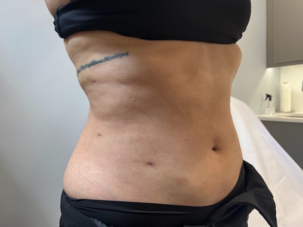 1Aesthetic | 1200 Ave at Port Imperial, Weehawken Township, NJ 07086, USA | Phone: (201) 313-8899