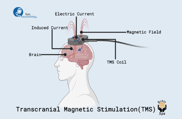 Brain Spa | TMS Neurofeedback Botox PRP | 3600 North Star Road #140, Richardson, TX 75082, USA | Phone: (469) 493-1964