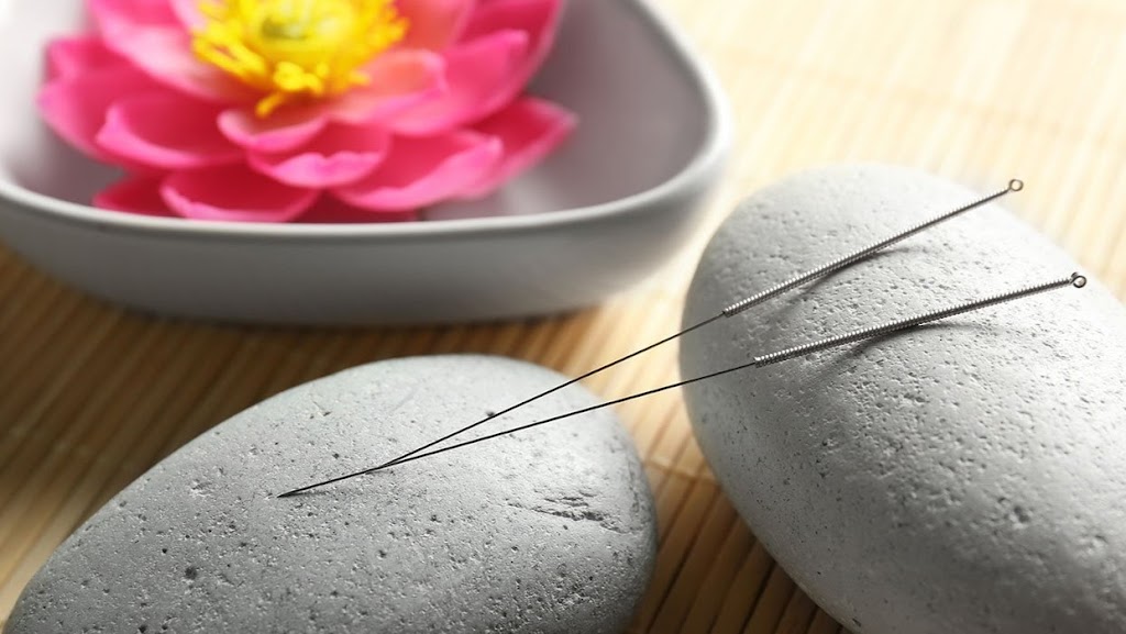 DH Acupuncture: Donghwan Lee, LAc | 133 E 58th St #710, New York, NY 10022, USA | Phone: (917) 881-9304