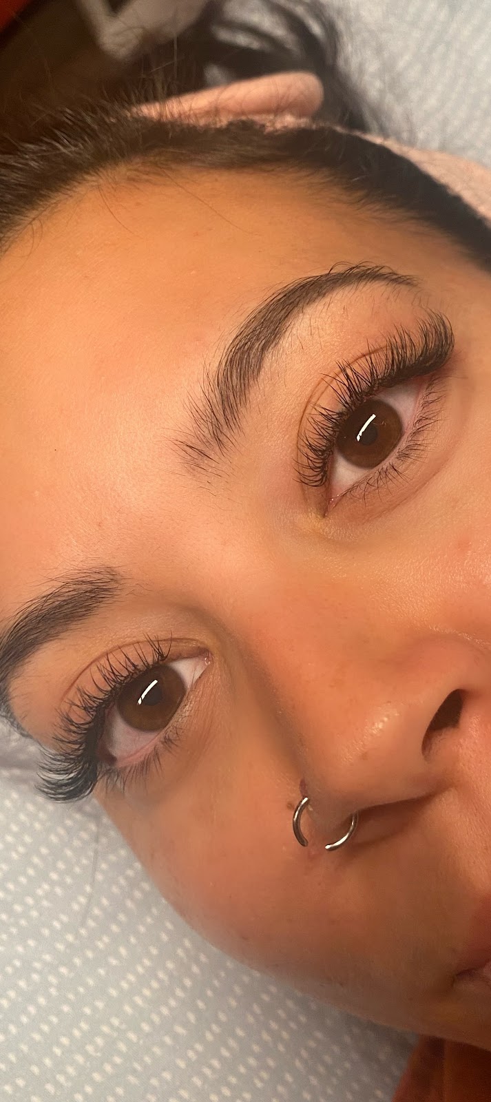 Luna Sol Aesthetics | 11407 US-301, Belleview, FL 34420, USA | Phone: (727) 318-3922