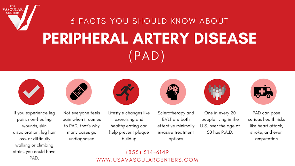 USA Vascular Centers | 864 Granville Payne Ave, Brooklyn, NY 11207, USA | Phone: (646) 798-8502