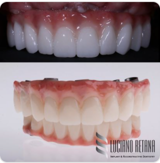 Dr. Luciano Retana, Dental Implants in Dallas | 7001 Preston Rd #205, Dallas, TX 75205, USA | Phone: (214) 810-0170