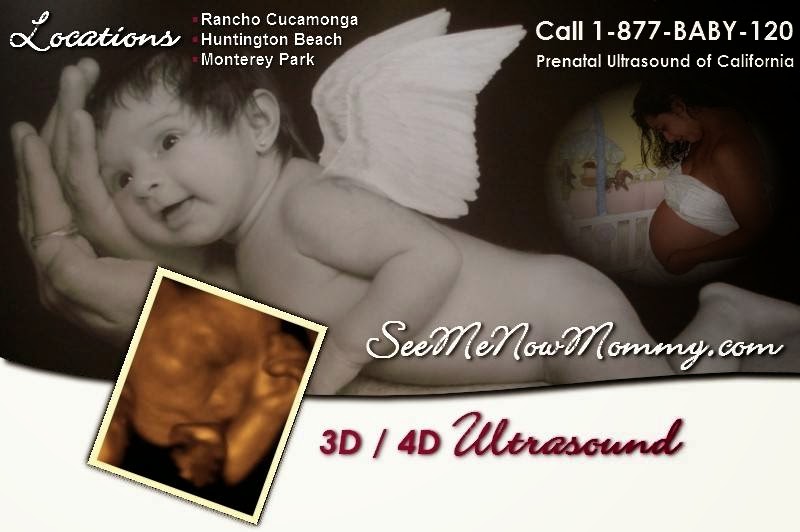 Prenatal Ultrasound Ca | 215 W Pomona Blvd #100, Monterey Park, CA 91754, USA | Phone: (626) 572-2709