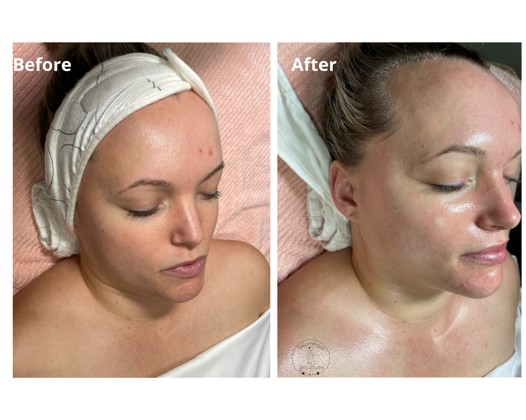 Beluminous Skin Studio | 763 S Main St Suite 121, Orange, CA 92868, USA | Phone: (714) 553-1466