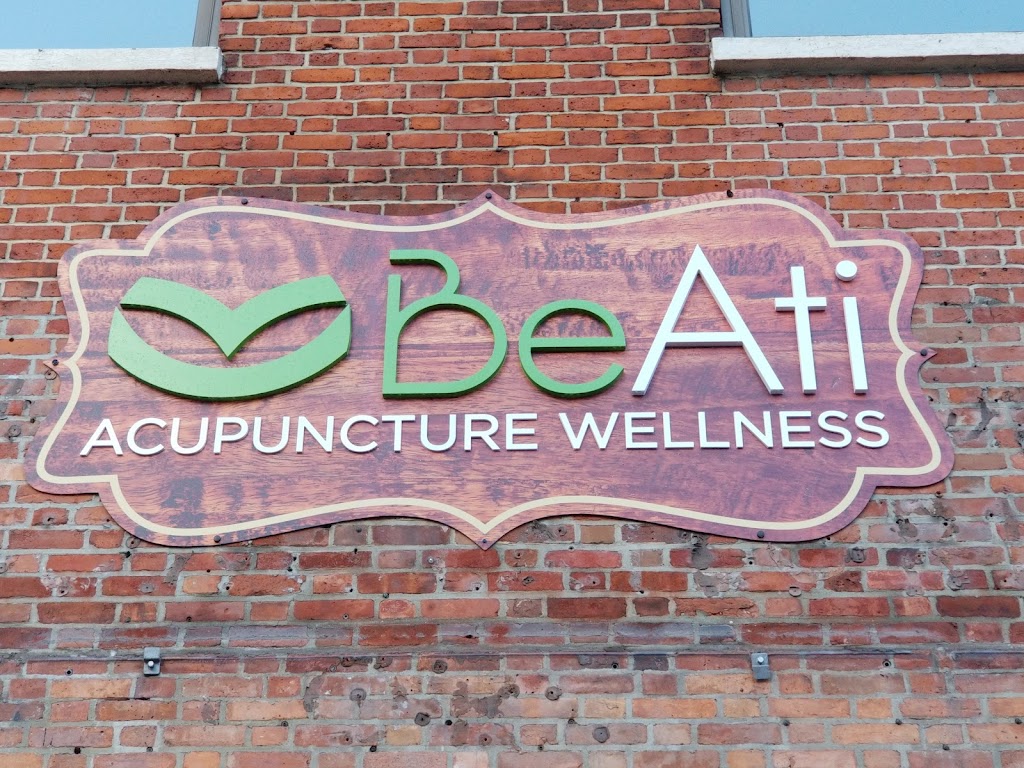 BeAti Acupuncture Wellness Clinic | 146 State St, Albany, NY 12207, USA | Phone: (518) 859-4648