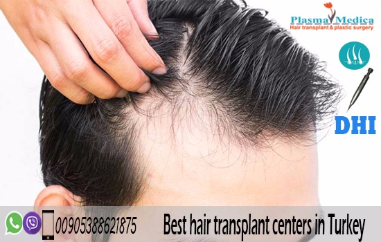 Plasmamedica Hair Transplant Istanbul Turkey | 2425 w 22nd St#205, Oak Brook, IL 60523, USA | Phone: (630) 280-7449