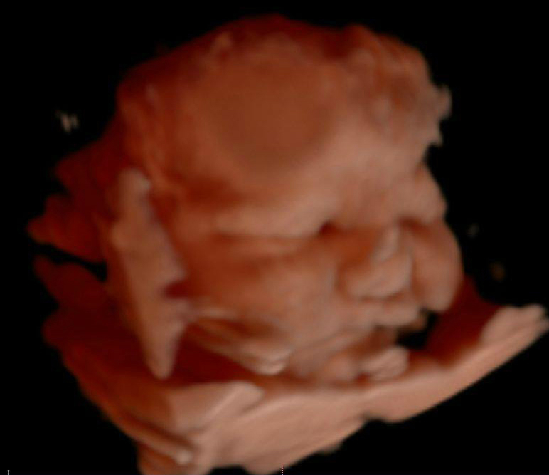 Keepsake Prenatal Imagaing 3D/4D HD Ultrasound Studio | 5656 US-29, Blairs, VA 24527, USA | Phone: (434) 429-1069