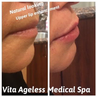 Vita Ageless Medical Aesthetics | 565 Cedar Swamp Rd, Glen Head, NY 11545, USA | Phone: (516) 626-6800