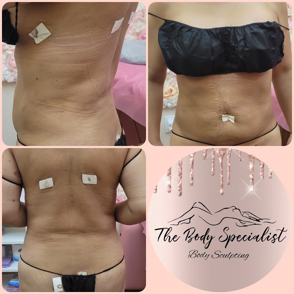 The Body Specialist Body Sculpting | 1690 Story Rd Suite 117-8, San Jose, CA 95122, USA | Phone: (669) 233-1576