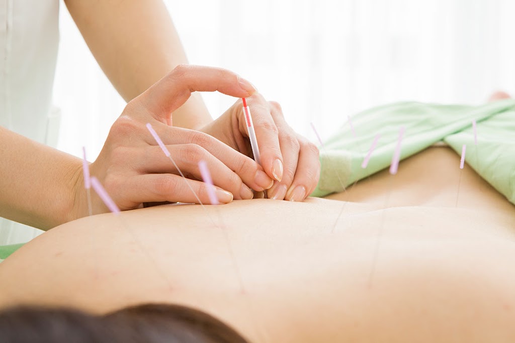 A Point of Health Acupuncture | 3551 Camino Mira Costa Suite L, San Clemente, CA 92672, USA | Phone: (949) 310-4044