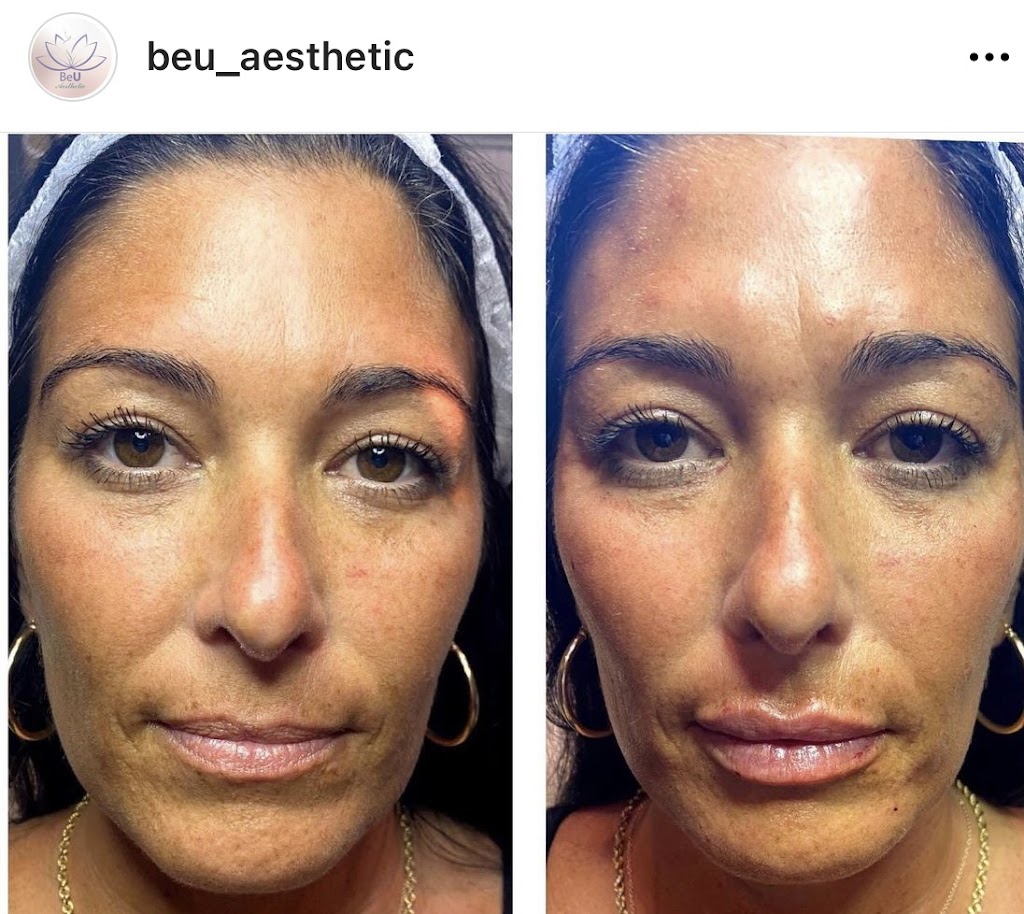 BeU Aesthetic | 10 Broadway, Valhalla, NY 10595, USA | Phone: (917) 238-8361